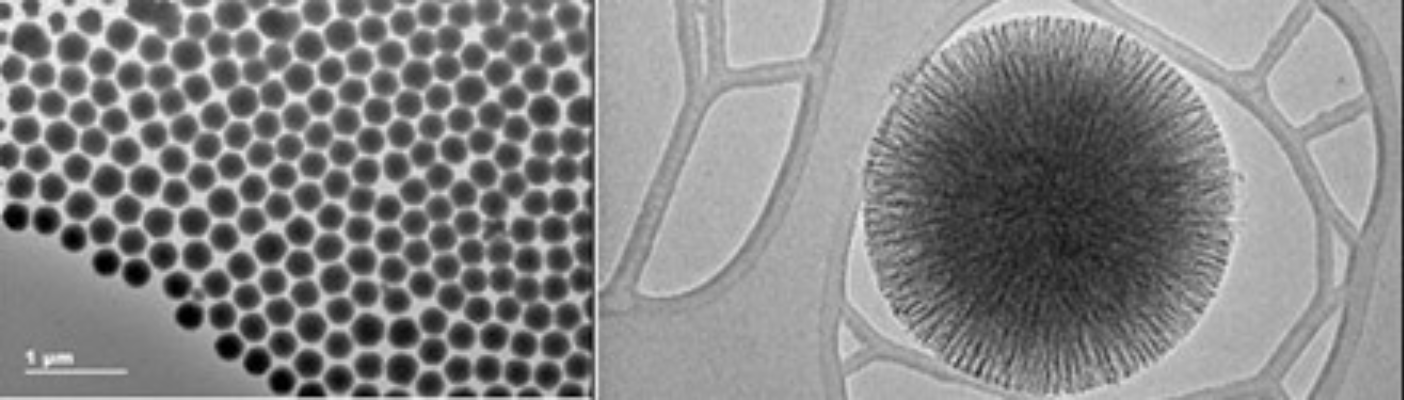 图1:KCC-1的过渡电子显微镜图像