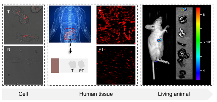 图5：QM-HSP-CPP实现人切片和异位裸小鼠模型对胰腺癌的检测<sup>[3]</sup>
