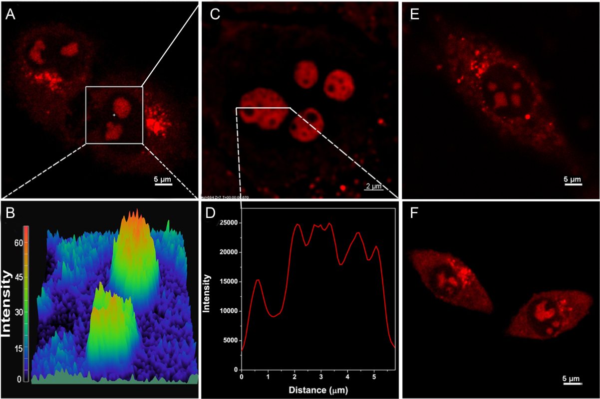 图1 Fluorescent images of living cells by CP. (A) CP(5 μM) was incubated with Hela cells in DMEM for 20 min and imaged<sup> [1] </sup>.
