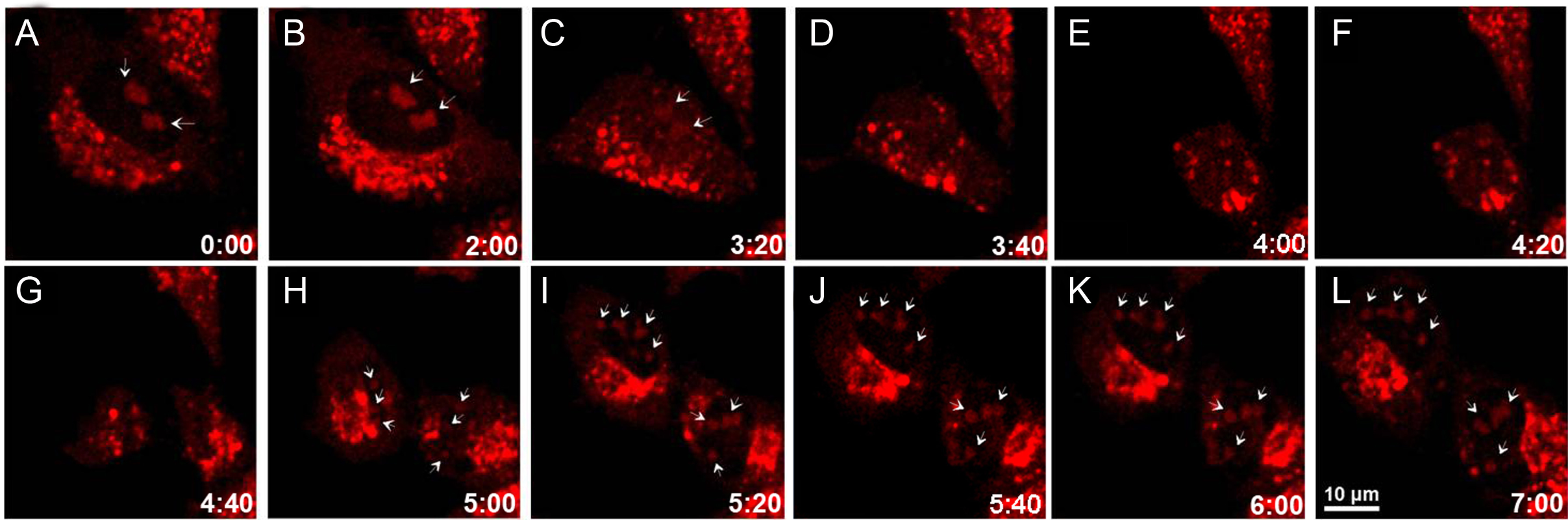 图3 Dynamics ofnucleoliofstainedHeLacellsby CP during mitosis.(A–I) Time-dependent fluorescence imaging after addition of 5 mM CP<sup> [1] </sup>.