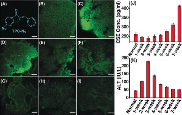 图2 Two-photon imaging of TPC-N<sub>3</sub> (10 mm) in liver tissue of cirrhotic mice: A) Normal mice liver tissue only. Inset: the chemical structure of TPC-N<sub>3</sub> . B) Normal mice liver tissue with TPC-N<sub>3</sub> , C)–I) mice with CCl4 treatment after 1 to 7 weeks, liver tissue extracted then incubated with TPC-N<sub>3</sub> . Excitation: 810 nm. Emission: 500–560 nm. Scale bar: 150 mm. J) Quantification of cystathionine g lyase (CSE) levels in normal and cirrhosis liver tissue by ELISA. K) Serum ALT levels in normal and cirrhosis mice. <sup>[1]</sup>