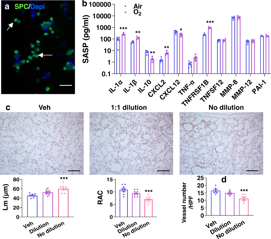 图1 C57BL/6 J neonatal mice (<12 h old) were exposed to air or hyperoxia (95% O2) for 3 days followed by air recovery until pnd7. Senescent type II cells were isolated from these mice through the sorting of pro-SPC and C12FDG positive cells.<sup>[1]</sup>
