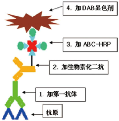 图1 ABC法示意图