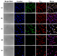 图2 Functional imaging of hCYP3A4 in living Hep3B (a, b) and MCF-7 (c-e) cells using confocal laser scanning microscopy. The Hep3B (a) and MCF-7 (c) cells were incubated with NFa (20 μm, green channel) for 1 h, Hoechst33342 (blue channel), and ER tracker (red channel) for 15 min. The Hep3B (b) and MCF-7 (d) cells were treated with RTV (20 μm) for 1 h, following staining by NFa for 1 h and staining by Hoechst33342 and ER tracker for 15 min. The MCF-7 (e) cells were treated with KET (20 μm) for 1 h, following staining by NFa for 1 h and staining by Hoechst33342 and ER tracker for 15 min. Scale bar: 50 μm.